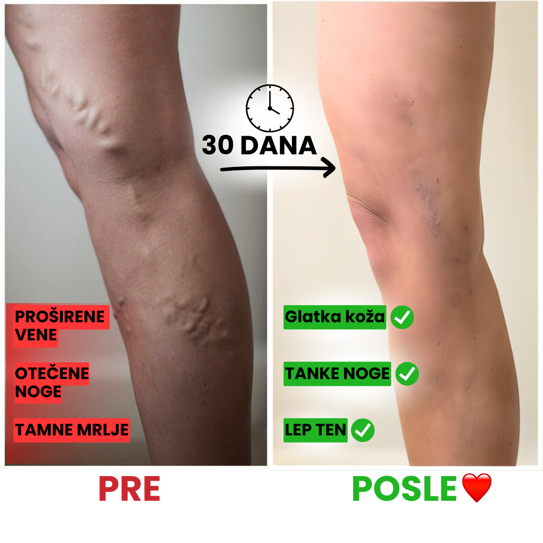 Čarape Za Bolju Cirkulaciju